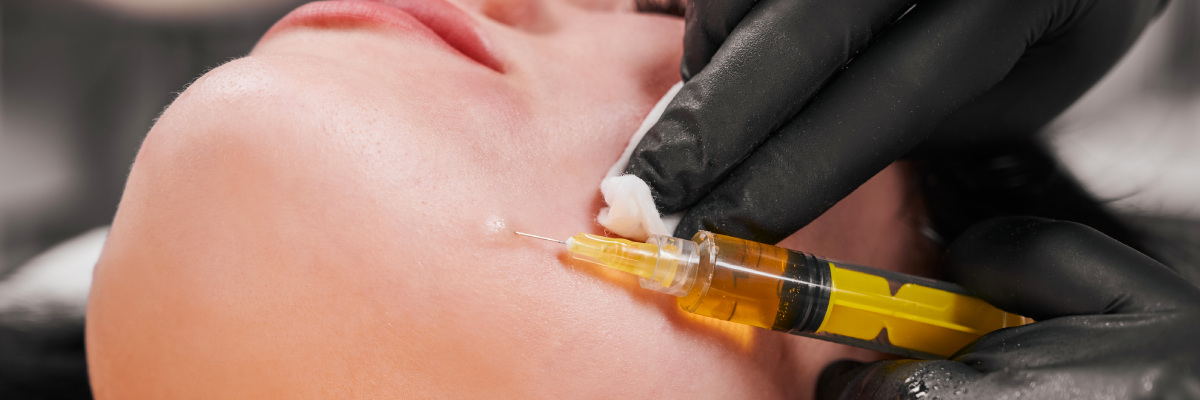 Close-up of woman receiving a PPR facial procedure needle to her left cheek