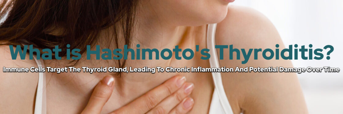 What is Hashimoto's Thyroiditis?