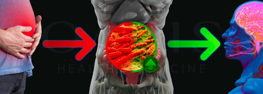 A visual representation of the interconnectedness between gut and brain function in functional medicine