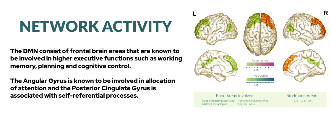 Imaging model of the network activity of the human brain