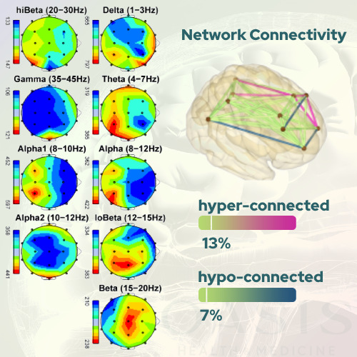 Visualization of qEEG brainmap